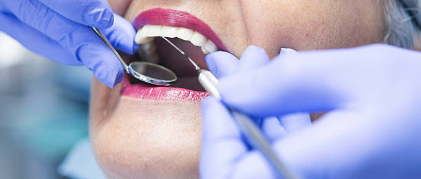 Best Knocked-Out Tooth (Avulsed Tooth) Treatment in Melrose, MN